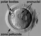 human zygote two pronuclei 22