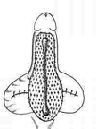 redrawn-penis-diagram